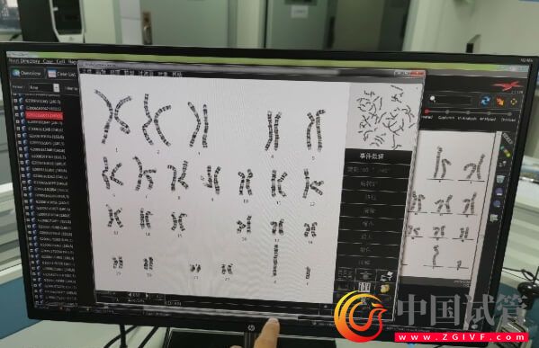 詳解染色體易位的三種類型,引起原因除輻射外還有...(圖1) 詳解染色體易位的三種類型,引起原因除輻射外還有...(圖1)