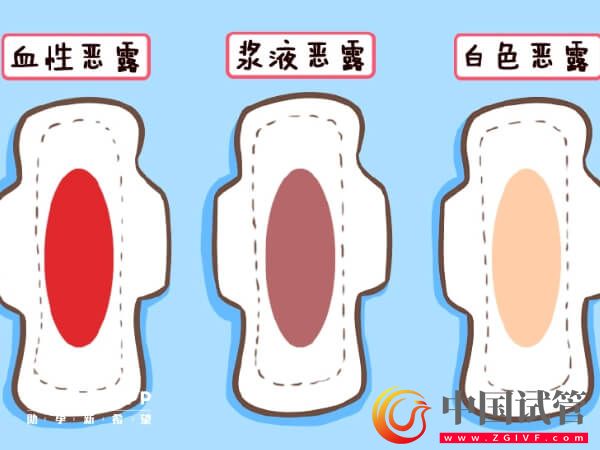 盤點(diǎn)產(chǎn)后惡露會有幾種顏色,出現(xiàn)黑色就需注意了!(圖1) 盤點(diǎn)產(chǎn)后惡露會有幾種顏色,出現(xiàn)黑色就需注意了!(圖1)