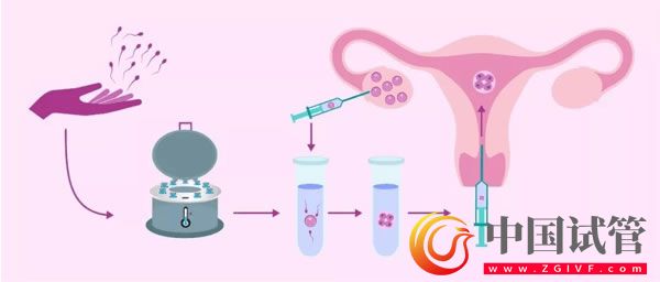 37歲大齡女性卵巢早衰閉經怎么治最快最有效？(圖1)