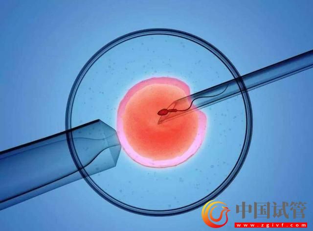 新一代試管嬰兒技術(shù)問(wèn)世 專家:每年可多生十萬(wàn)人(圖1) 新一代試管嬰兒技術(shù)問(wèn)世 專家:每年可多生十萬(wàn)人(圖1)