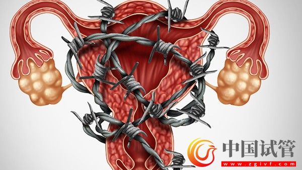 女性想要保護(hù)卵巢健康這些事要做好(圖2) 女性想要保護(hù)卵巢健康這些事要做好(圖2)