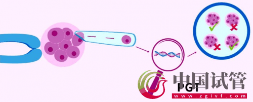 什么是PGT、PGS和PGD?(圖2) 什么是PGT、PGS和PGD?(圖2)