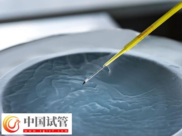 新鄉供卵試管嬰兒2個月就能完成，但這五個步驟可不能忽視(圖2)