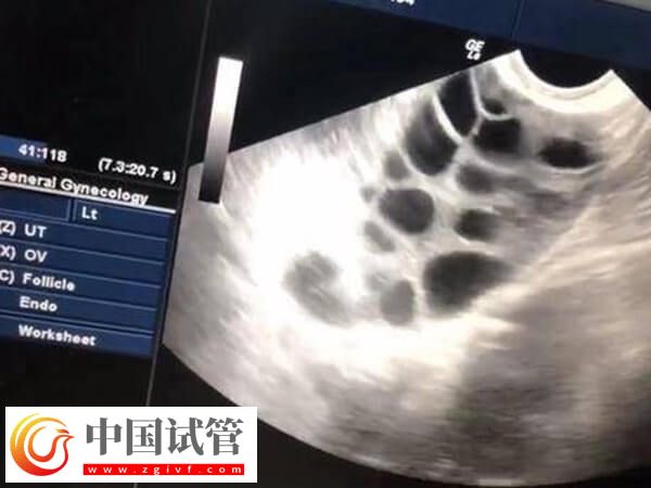 柳州三代試管嬰兒攻略，內含醫院及助孕價格介紹(圖1)