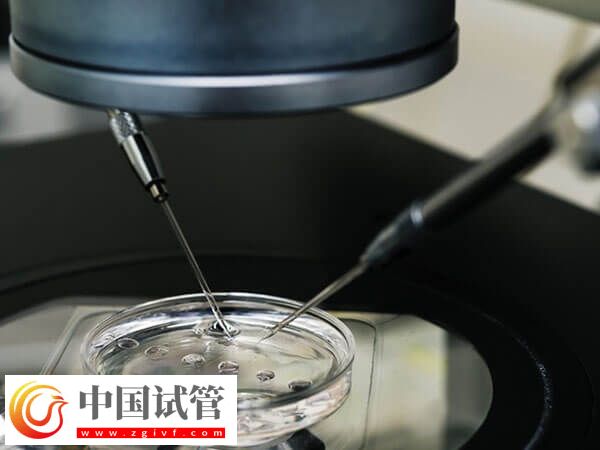 綿陽市中心醫院助孕全程開銷匯總，檢查到手術至少3w(圖1)