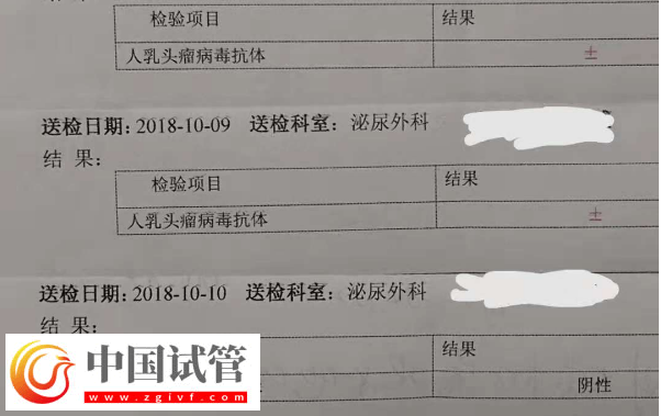 通過hpv報告單圖片怎么判斷自己是正常的呢?(圖2) 通過hpv報告單圖片怎么判斷自己是正常的呢?(圖2)