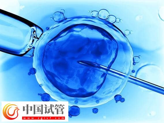 長沙試管嬰兒平均成功率高達65%,滿足這三個條件即可申請(圖3) 長沙試管嬰兒平均成功率高達65%,滿足這三個條件即可申請(圖3)