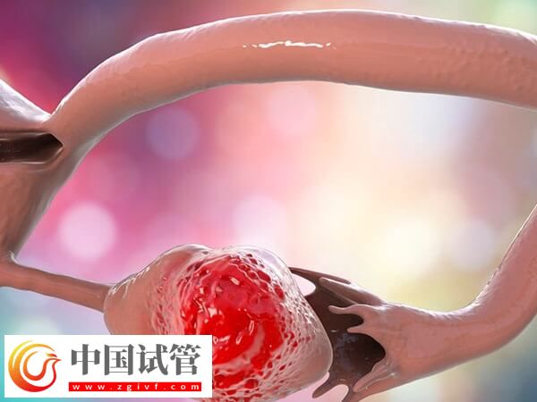 試管嬰兒也有弊端，提前了解各階段注意事項(xiàng)可減少風(fēng)險(xiǎn)(圖2)