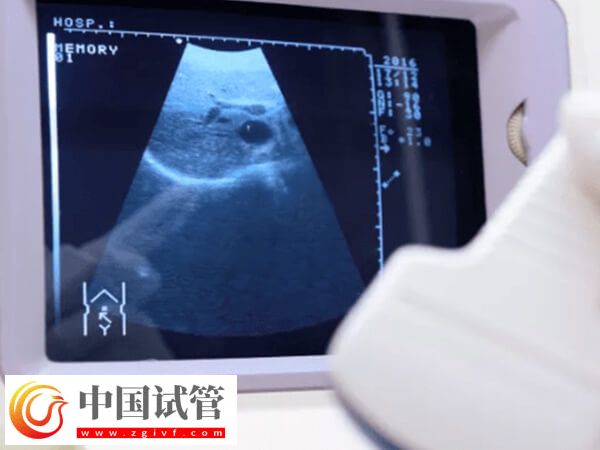 試管嬰兒查體到移植至少2個月，期間做好這些更容易成功(圖2)