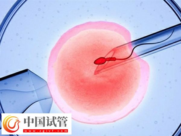 沒有子宮能生孩子嗎(圖5) 沒有子宮能生孩子嗎(圖5)