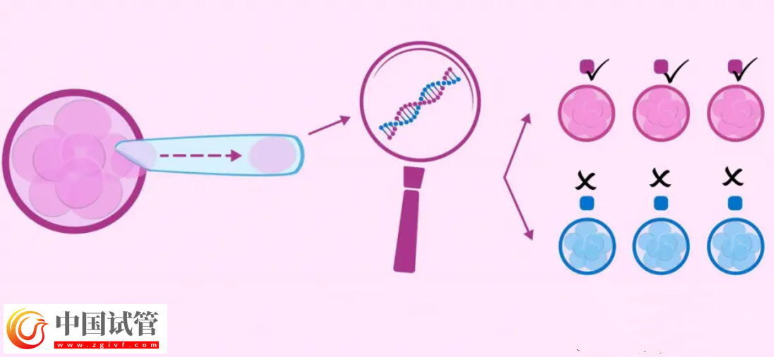 囊胚等級與寶寶健康之間有關系嗎？(圖1)