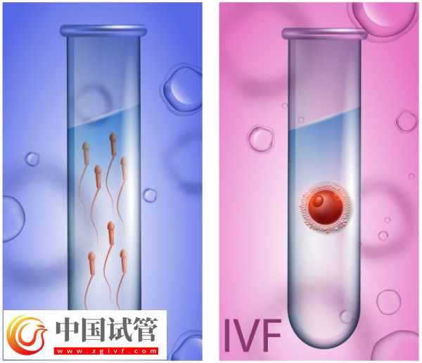 天津試管嬰兒費用詳解：全面了解價格及影響因素(圖1)