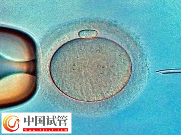 廣州市第一人民醫院試管嬰兒價格，養囊4千起(圖1)