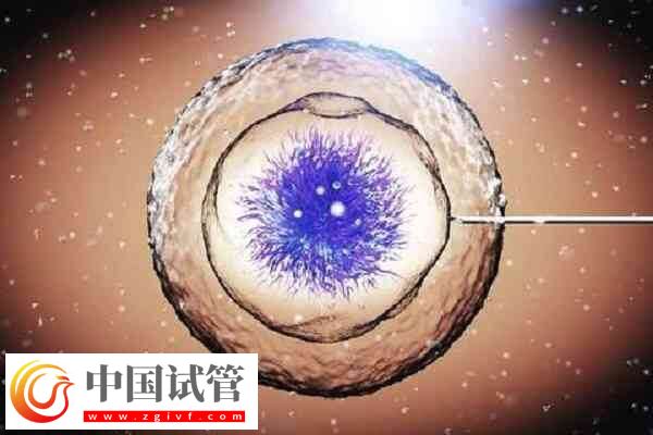 一代試管嬰兒受精失敗精卵不結合的原因有哪些？(圖1)