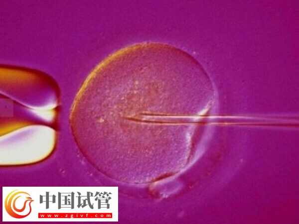 反復生化是什么原因導致的 生化妊娠(圖1)