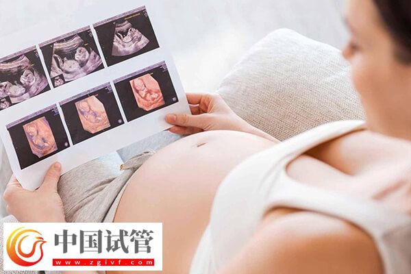 孕檢單怎么看男女 生男生女(圖1)