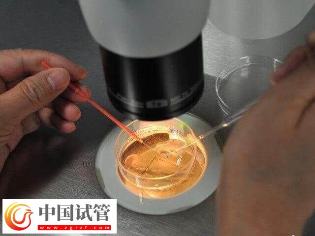 胚胎培養(yǎng)液對(duì)試管嬰兒有沒(méi)有影響(圖1) 胚胎培養(yǎng)液對(duì)試管嬰兒有沒(méi)有影響(圖1)