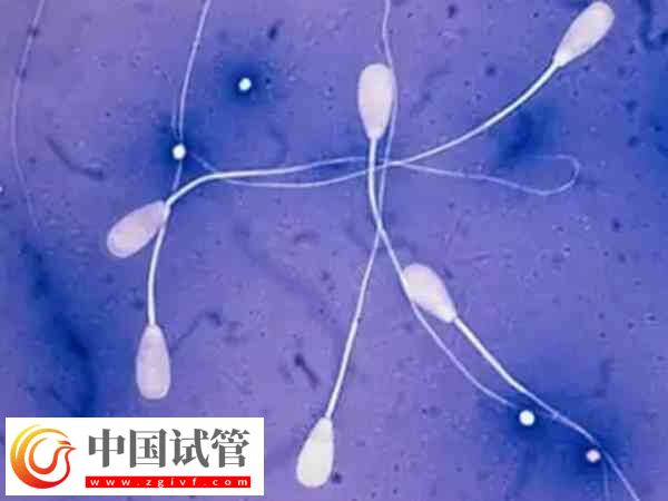 弱精少精是什么原因?qū)е碌?圖1) 弱精少精是什么原因?qū)е碌?圖1)