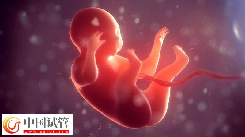 羊水渾濁是什么原因造成的(圖1)