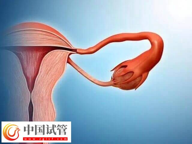 子宮偏小對(duì)試管嬰兒的影響有哪些(圖1) 子宮偏小對(duì)試管嬰兒的影響有哪些(圖1)