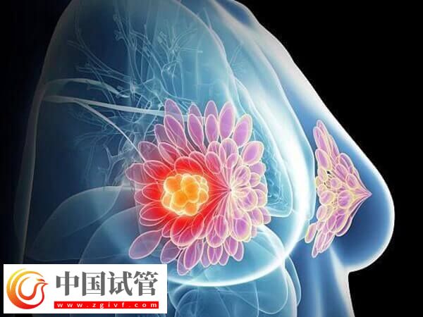 移植后乳房越來越軟的原因是什么(圖1)