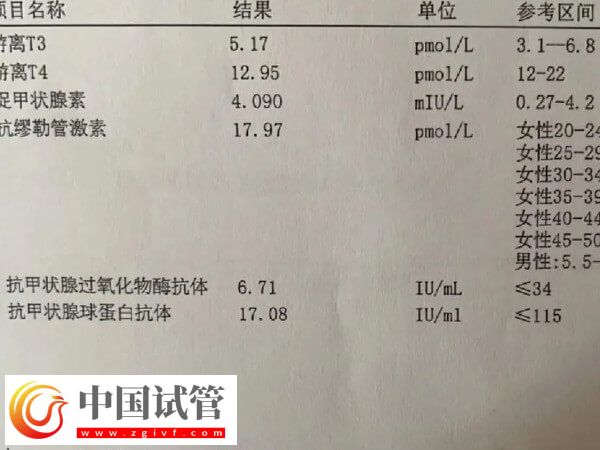 為什么41歲女人做試管嬰兒會(huì)失敗?背后真相大揭秘(圖1) 為什么41歲女人做試管嬰兒會(huì)失敗?背后真相大揭秘(圖1)