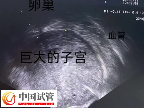 為什么41歲女人做試管嬰兒會(huì)失敗?背后真相大揭秘(圖2) 為什么41歲女人做試管嬰兒會(huì)失敗?背后真相大揭秘(圖2)