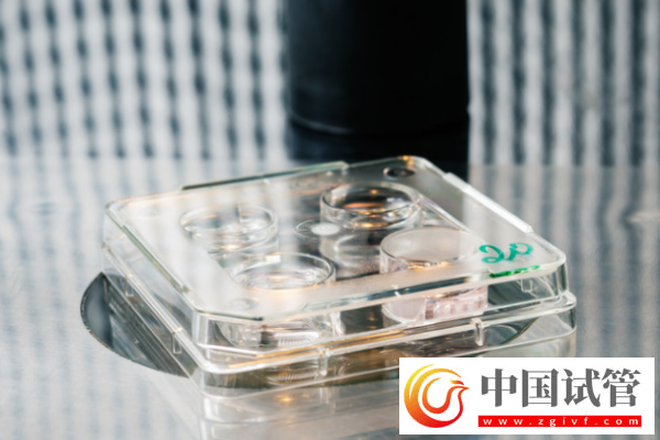 試管嬰兒全攻略:9大常識(shí)不可不知!(圖3) 試管嬰兒全攻略:9大常識(shí)不可不知!(圖3)