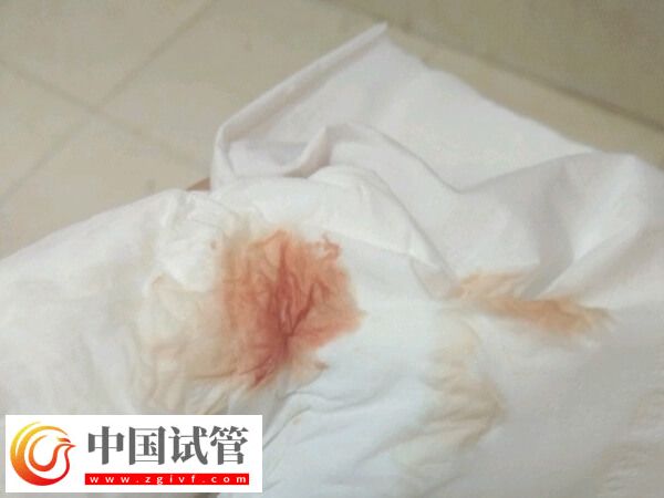 移植著床會(huì)有什么反應(yīng)(圖1) 移植著床會(huì)有什么反應(yīng)(圖1)