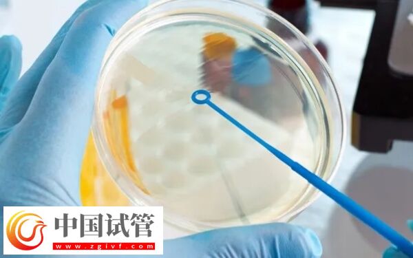 不能移鮮胚什么原因(圖1) 不能移鮮胚什么原因(圖1)