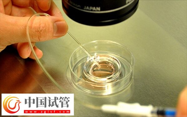 不能移鮮胚什么原因(圖2) 不能移鮮胚什么原因(圖2)