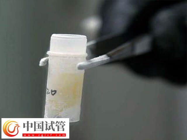 試管進(jìn)入周期要做什么(圖2) 試管進(jìn)入周期要做什么(圖2)