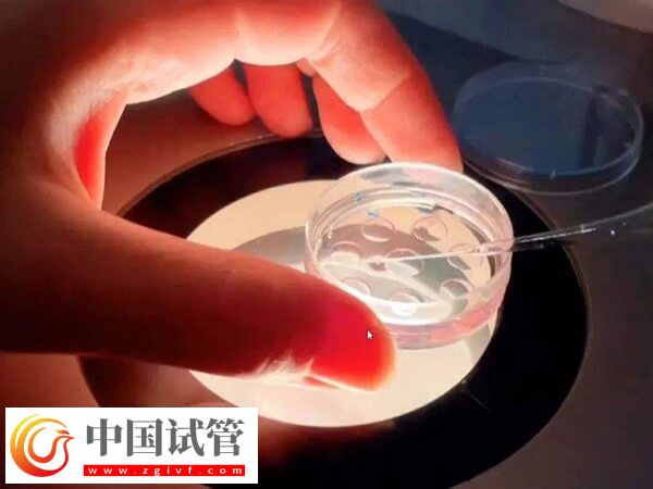 試管進(jìn)入周期要做什么(圖1) 試管進(jìn)入周期要做什么(圖1)
