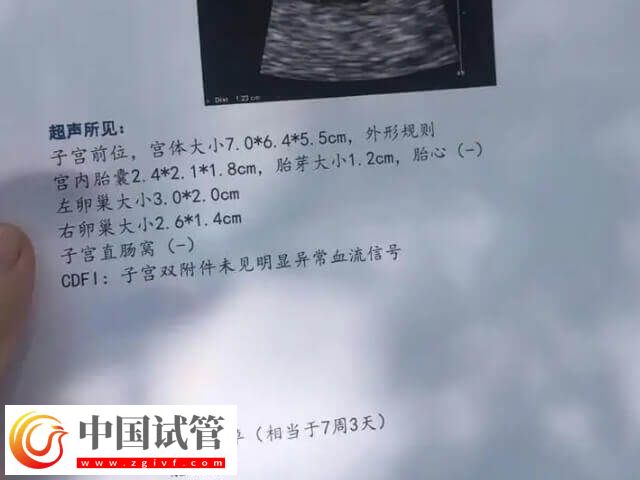 試管移植成功為什么會胎停(圖1)