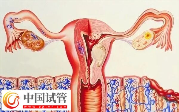 子宮內膜厚度多少做試管嬰兒才能成功著床?(圖3) 子宮內膜厚度多少做試管嬰兒才能成功著床?(圖3)