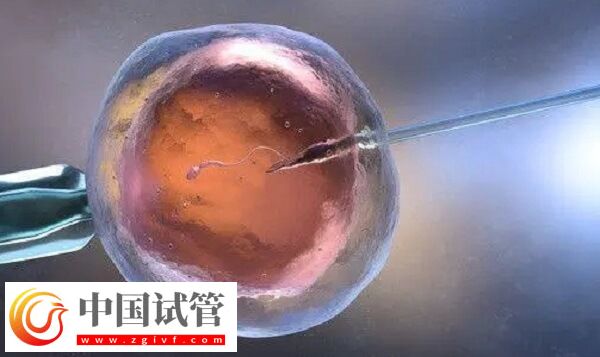 雌激素高做試管前怎么辦(圖1) 雌激素高做試管前怎么辦(圖1)