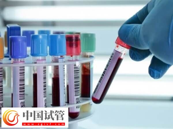 試管移植14天后做什么檢查(圖2)