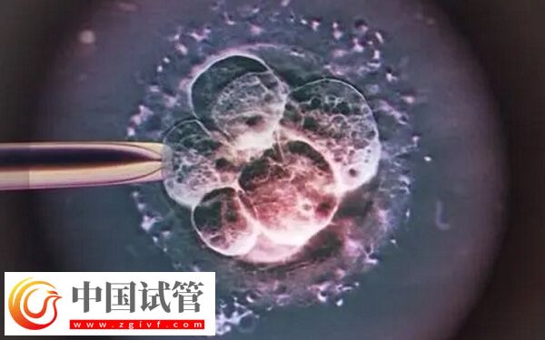 移植一個凍胚8c2成功率高不高(圖1)