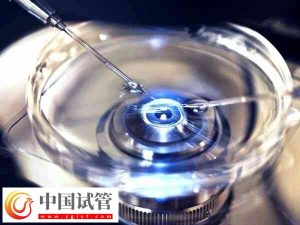 影響取卵的因素有哪些(圖1)