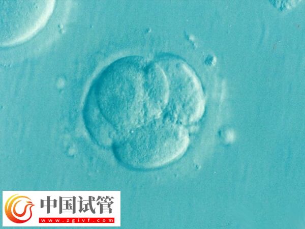 試管養(yǎng)囊成功的是否都是優(yōu)胚(圖2) 試管養(yǎng)囊成功的是否都是優(yōu)胚(圖2)