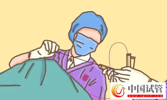 試管嬰兒有哪些出乎意料的概念？(圖4)