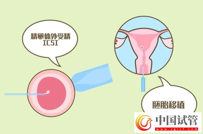 試管嬰兒有哪些出乎意料的概念？(圖6)