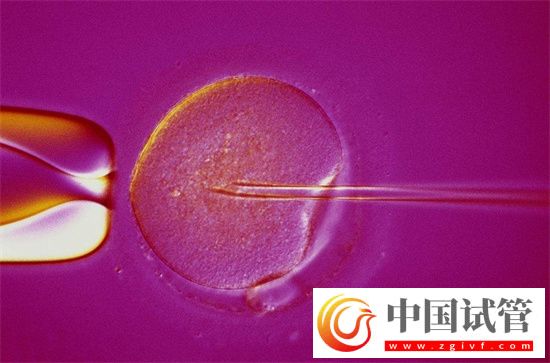 試管打了降調(diào)針為什么還是失敗了?盤點試管失敗的多種因素插圖1 試管打了降調(diào)針為什么還是失敗了?(圖2)