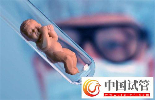 做試管嬰兒醫(yī)生為什么建議攢胚胎?適合攢胚胎的人群是這些插圖1 做試管嬰兒醫(yī)生為什么建議攢胚胎?(圖2)