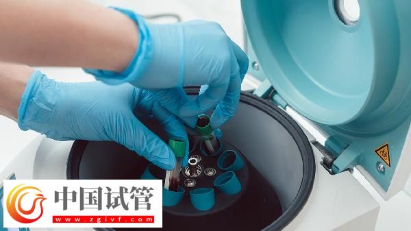 血常規五項是哪五項(圖3)