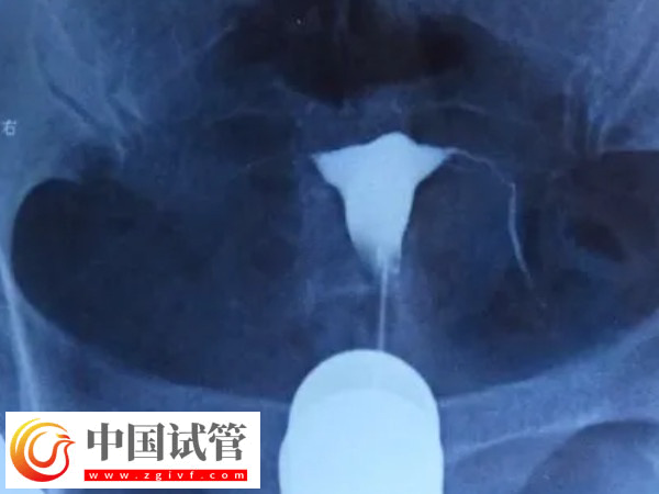 北京試管嬰兒要什么證件(圖2) 北京試管嬰兒要什么證件(圖2)