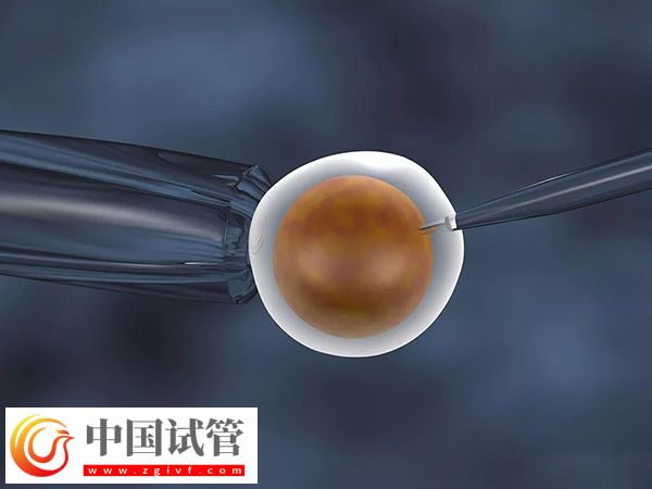 2025在西班牙做試管嬰兒需要什么條件(圖3)