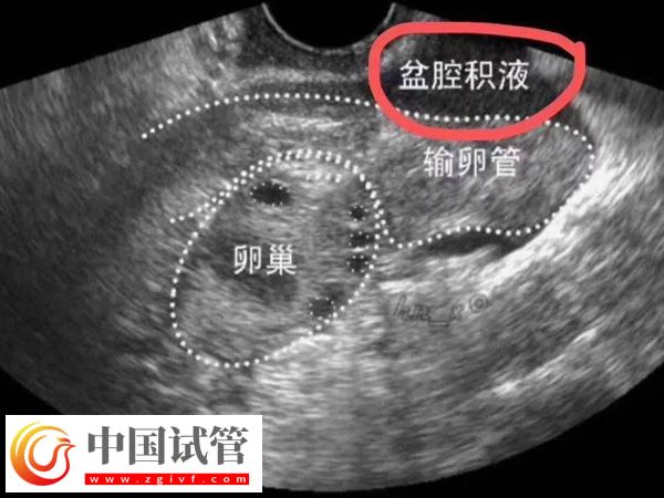 2025在西班牙做試管嬰兒需要什么條件(圖4)