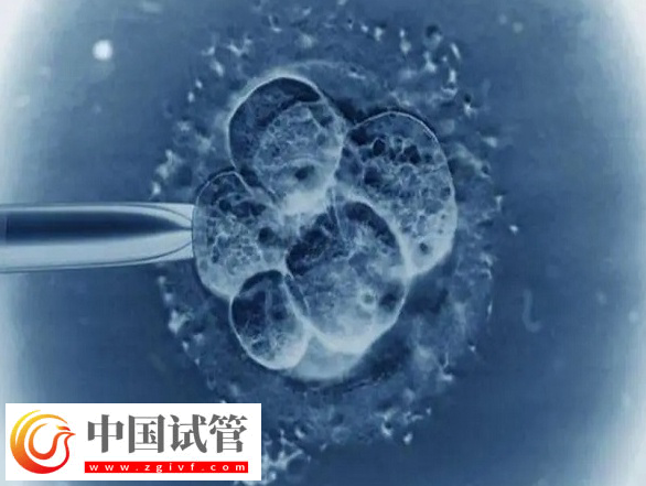 2025加拿大試管嬰兒成不成熟(圖1) 2025加拿大試管嬰兒成不成熟(圖1)