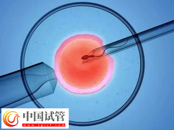 高齡試管有什么風險(圖2)